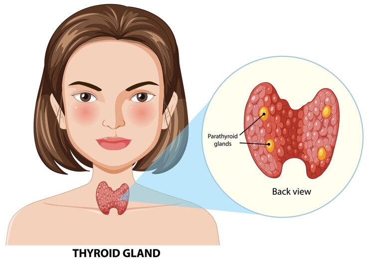 Underactive Thyroid An Autoimmune Disease Underactive Thyroid An Autoimmune Disease