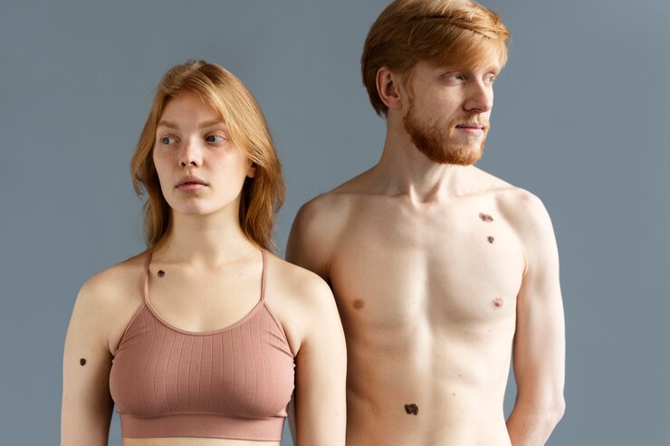 Bottom Surgery Female To Male Bottom Surgery Female To Male
