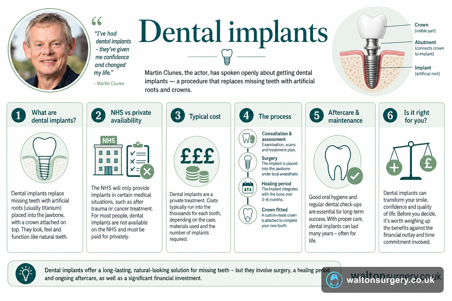 Dental implants: What to know from Martin Clunes' story