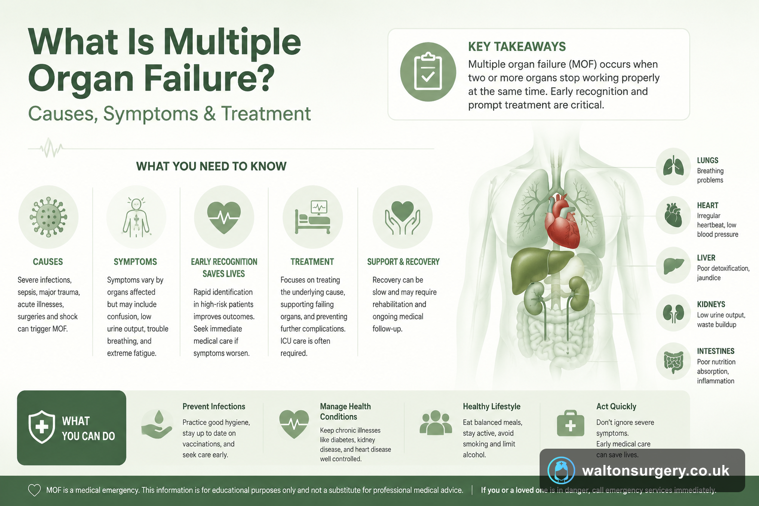 What Is Multiple Organ Failure? Causes, Symptoms & Treatment